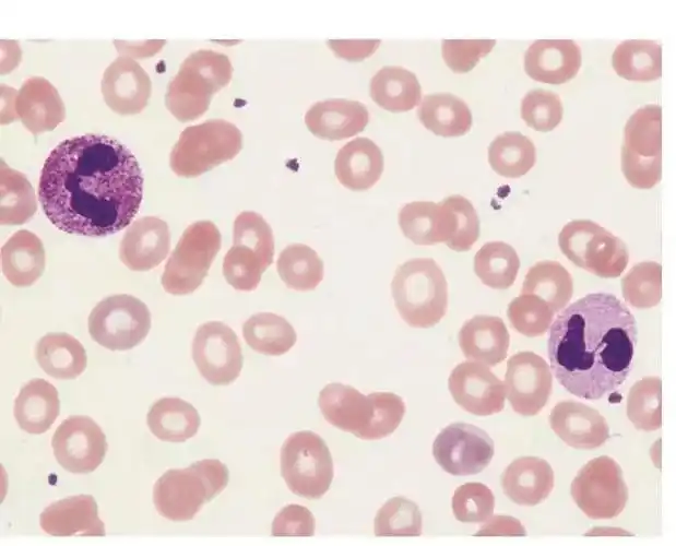 中性粒细胞毒性变化