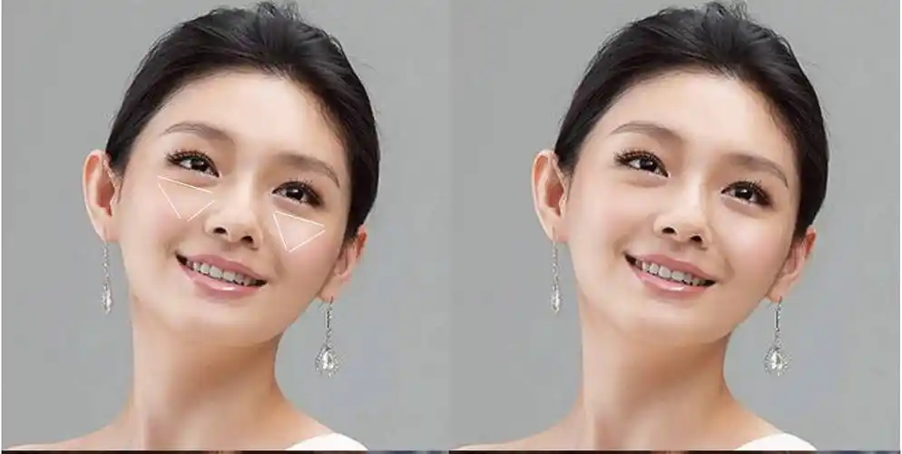 女明星扮嫩必备苹果肌 竟然可以化出来