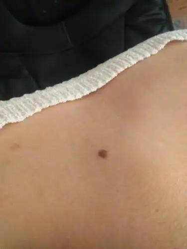 有苦情痣的女人,爱情真的不顺吗