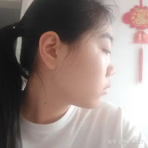 侧脸很平啊 怎么办啊 感觉脸就是一条线下去了 特别丑 眼睛近视还突