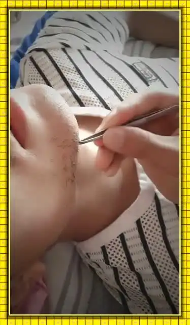 这样拔胡子虽然疼,但是对于拔胡子的人,是真的爽啊