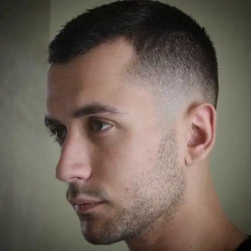 m型发际线发型_m型发际线发型女生-都市码头小百科