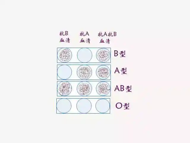 交叉配血试验方法及注意事项
