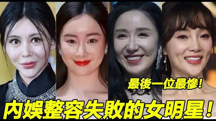 内娱整容失败的女明星!蛇精脸,猪鼻头,面容殭,最后一位最惨!
