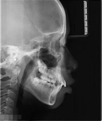 但缺点在于,图片上的牙齿容易失真