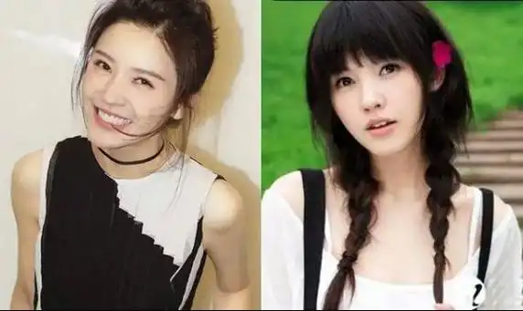 杨子姗是兜赤地包天吗 杨子姗整容前的样子照片-走红网