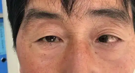 眼睛能决定命运自测下你是哪种眼睛看完涨知识了