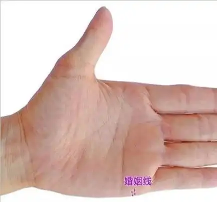 月丘有一条清晰的斜纹