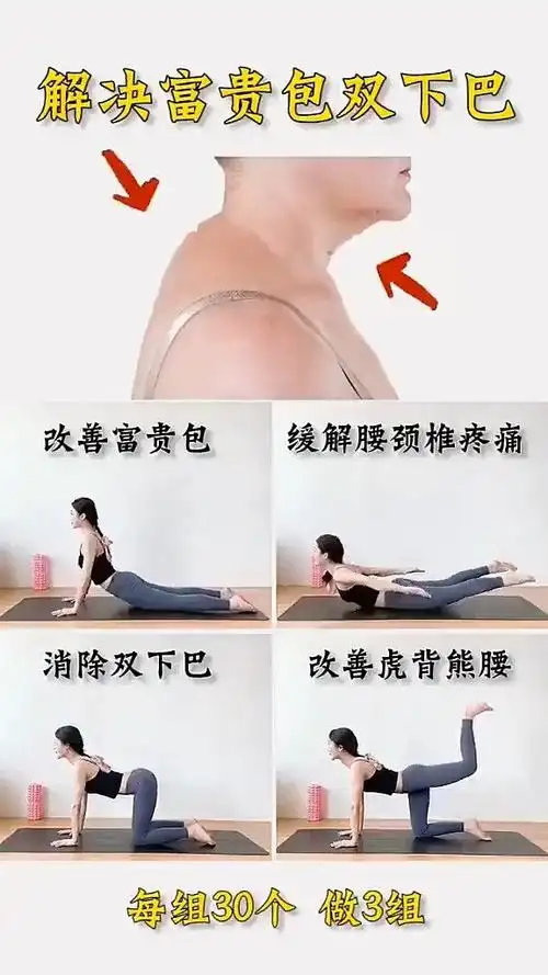 双下巴富贵包,让颈部显得又短又粗,跟我练,还你天