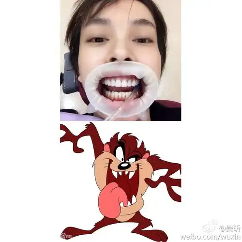 吴昕的嘴巴里含着一辆宝马!