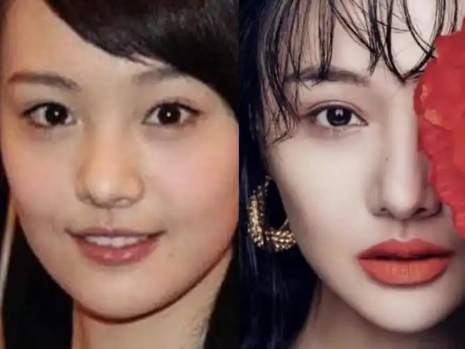 郑爽整容前后,这个变化也太大了吧