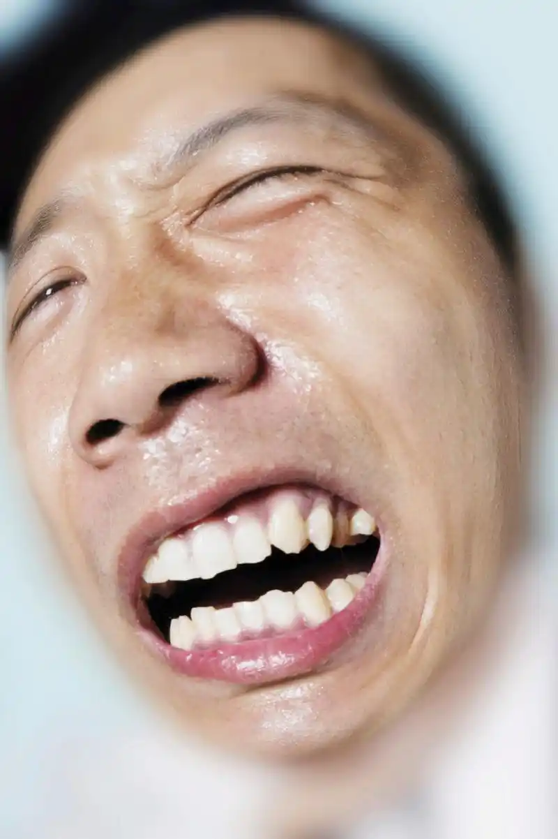 龅牙#   在矫正牙齿的过程中,不同的患者会有不同的需要和反应.