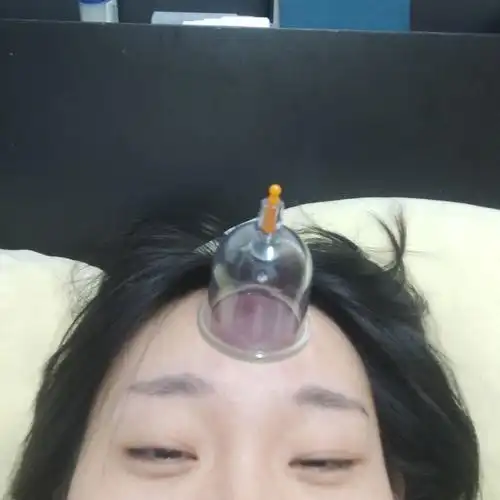 脑门上拔火罐,排毒去污_高清图集_新浪网