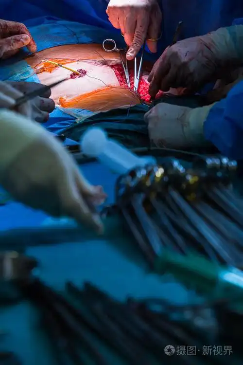 在现代医院的外科手术