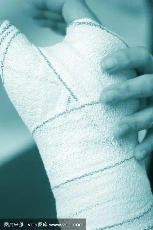 医生给病人敷石膏绷带