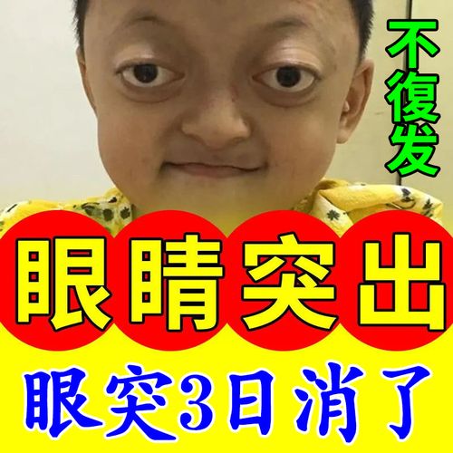 近视眼药水_甲亢眼突【3日冶好】眼球突出眼睛水肿甲亢眼突近视眼干涩