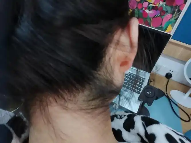 后发际线占领脖子星人前来求救