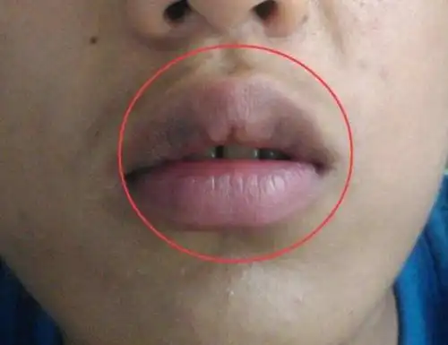 公认最丑的3大"唇形",让你知道什么叫做"一张嘴毁掉整张脸"!