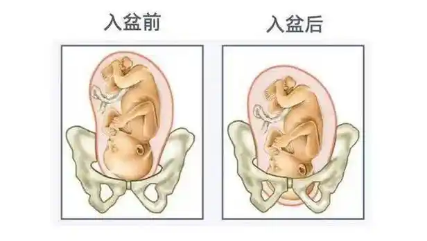 胎儿入盆是指孕晚期,胎儿的头部会朝下,屁股会朝上,身子会卷曲着.