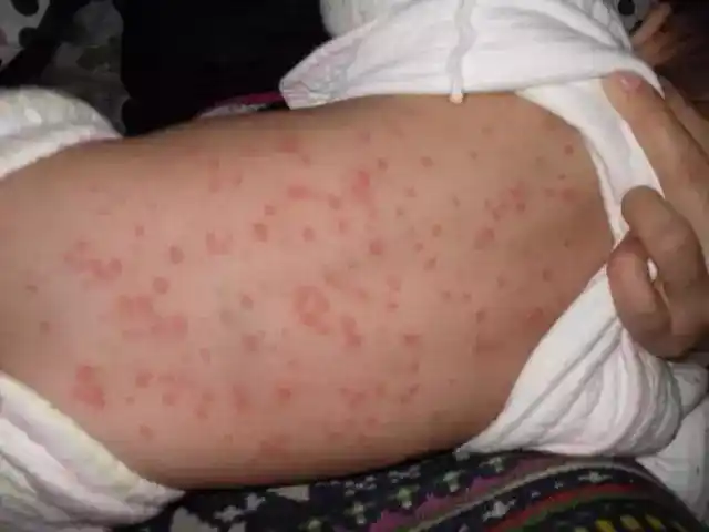 你以为清洗 暴晒就能除掉600万只螨虫?别天真了,看这里