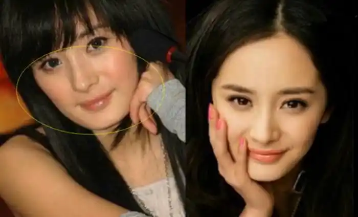 郑爽整容了吗当年郑爽直接承认整容