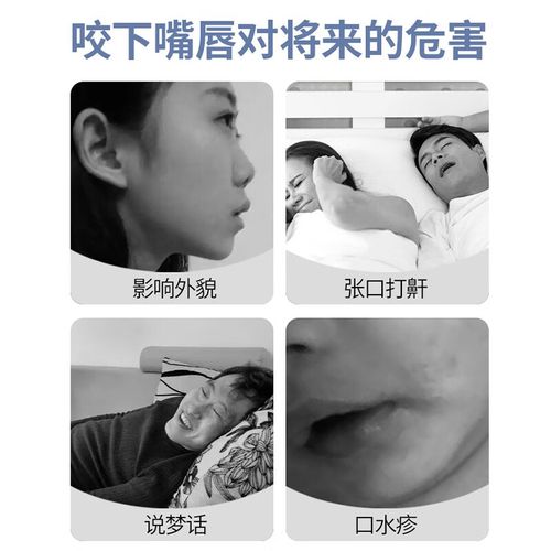 适用于小孩咬下嘴唇水咬嘴唇宝宝婴儿坏 一盒装