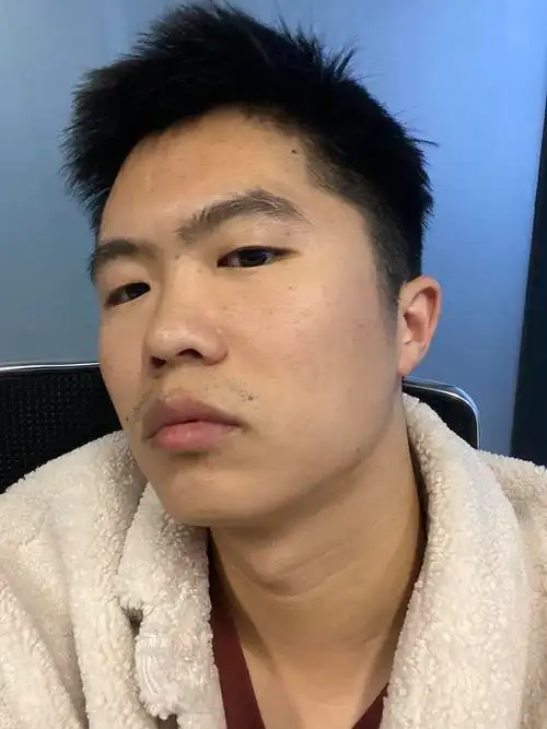 朋友都说我自拍巨丑真的吗