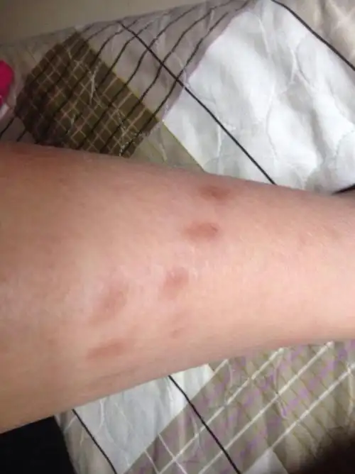 万能的妈圈有谁知道这黑印该怎么去掉